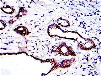 Anti-PKN2 antibody [1D1] used in IHC (Paraffin sections) (IHC-P). GTX60483