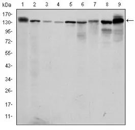 Anti-PKN2 antibody [1D1] used in Western Blot (WB). GTX60483