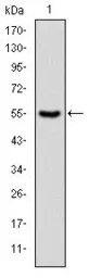 Anti-PKN2 antibody [1D1] used in Western Blot (WB). GTX60483