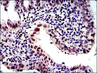 Anti-PSMB8 antibody [1A5] used in IHC (Paraffin sections) (IHC-P). GTX60486