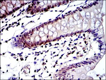 Anti-PSMB8 antibody [1A5] used in IHC (Paraffin sections) (IHC-P). GTX60486