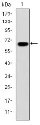 Anti-PSMB8 antibody [1A5] used in Western Blot (WB). GTX60486