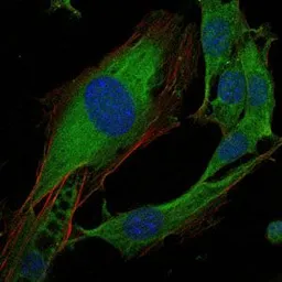 Anti-CRK antibody [3G11C1] used in Immunocytochemistry/ Immunofluorescence (ICC/IF). GTX60487
