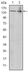 Anti-c-Kit antibody [1C5] used in Western Blot (WB). GTX60490