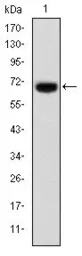 Anti-FOXP2 antibody [5C11A2] used in Western Blot (WB). GTX60500