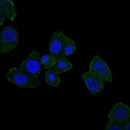 Anti-HFE antibody [3F1] used in Immunocytochemistry/ Immunofluorescence (ICC/IF). GTX60503