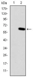Anti-HFE antibody [3F1] used in Western Blot (WB). GTX60503