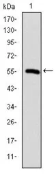 Anti-TCP1 beta antibody [5B5C4] used in Western Blot (WB). GTX60505