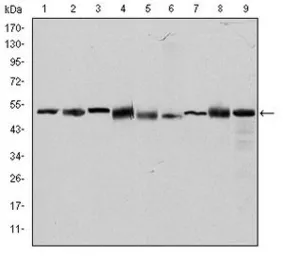 Anti-TCP1 beta antibody [5B5C4] used in Western Blot (WB). GTX60505