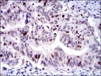 Anti-KIF22 antibody [5F3] used in IHC (Paraffin sections) (IHC-P). GTX60506