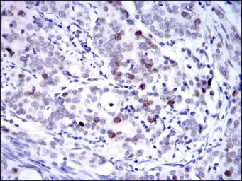 Anti-KIF22 antibody [5F3] used in IHC (Paraffin sections) (IHC-P). GTX60506