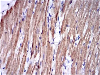 Anti-Troponin I fast skeletal muscle antibody [2F12A11] used in IHC (Paraffin sections) (IHC-P). GTX60507