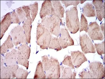 Anti-Troponin I fast skeletal muscle antibody [2F12A11] used in IHC (Paraffin sections) (IHC-P). GTX60507