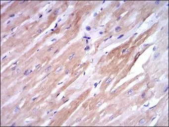 Anti-Troponin I fast skeletal muscle antibody [2F12A11] used in IHC (Paraffin sections) (IHC-P). GTX60507