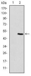 Anti-Troponin I fast skeletal muscle antibody [2F12A11] used in Western Blot (WB). GTX60507