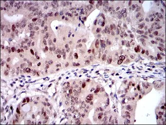 Anti-KIF22 antibody [1E3] used in IHC (Paraffin sections) (IHC-P). GTX60508