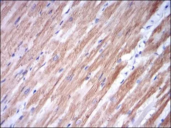 Anti-Troponin I fast skeletal muscle antibody [2F12A8] used in IHC (Paraffin sections) (IHC-P). GTX60509