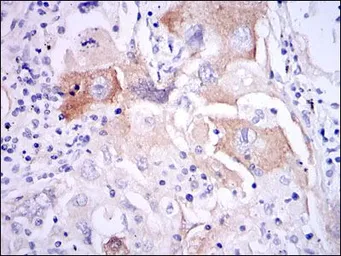 Anti-IL1 beta antibody [3A6] used in IHC (Paraffin sections) (IHC-P). GTX60513