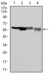 Anti-G6PD antibody [5E12] used in Western Blot (WB). GTX60515