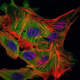 Anti-Myelin basic protein antibody [2H9] used in Immunocytochemistry/ Immunofluorescence (ICC/IF). GTX60519