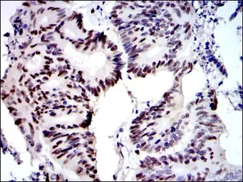 Anti-MCM2 antibody [1E7] used in IHC (Paraffin sections) (IHC-P). GTX60520