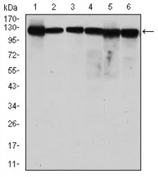 Anti-MCM2 antibody [1E7] used in Western Blot (WB). GTX60520