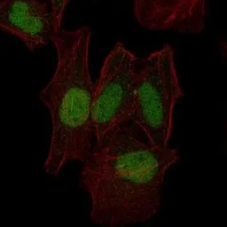 Anti-MEK7 antibody [4E5] used in Immunocytochemistry/ Immunofluorescence (ICC/IF). GTX60522
