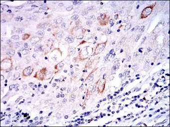 Anti-MEK7 antibody [4E5] used in IHC (Paraffin sections) (IHC-P). GTX60522