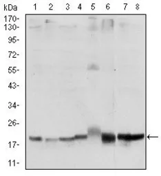 Anti-SKP1 antibody [4E11] used in Western Blot (WB). GTX60525