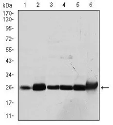Anti-GSTM1 antibody [1H4A4] used in Western Blot (WB). GTX60526