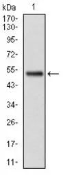 Anti-GSTM1 antibody [1H4F2] used in Western Blot (WB). GTX60527