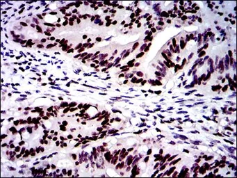 Anti-MSH6 antibody [3E1] used in IHC (Paraffin sections) (IHC-P). GTX60530