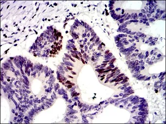 Anti-MSH6 antibody [3E1] used in IHC (Paraffin sections) (IHC-P). GTX60530