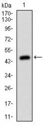 Anti-MSH6 antibody [3E1] used in Western Blot (WB). GTX60530