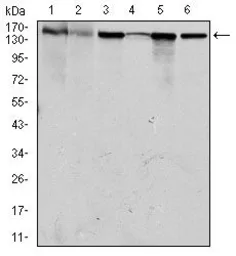 Anti-MSH6 antibody [3E1] used in Western Blot (WB). GTX60530