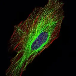 Anti-alpha Tubulin 8 antibody [2D6] used in Immunocytochemistry/ Immunofluorescence (ICC/IF). GTX60532