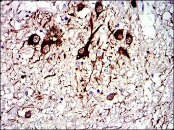 Anti-alpha Tubulin 8 antibody [2D6] used in IHC (Paraffin sections) (IHC-P). GTX60532