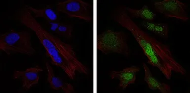 Anti-SOX9 antibody [1B11] used in Immunocytochemistry/ Immunofluorescence (ICC/IF). GTX60536