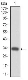 Anti-TPOR antibody [1H2] used in Western Blot (WB). GTX60540