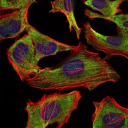 Anti-NF-L antibody [1H3] used in Immunocytochemistry/ Immunofluorescence (ICC/IF). GTX60541