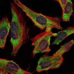 Anti-NF-L antibody [2G10] used in Immunocytochemistry/ Immunofluorescence (ICC/IF). GTX60544
