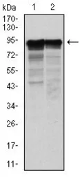 Anti-NF-L antibody [2G10] used in Western Blot (WB). GTX60544