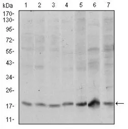 Anti-SKP1 antibody [1H9] used in Western Blot (WB). GTX60547