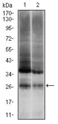 Anti-Ubiquitin B antibody [3C12] used in Western Blot (WB). GTX60548