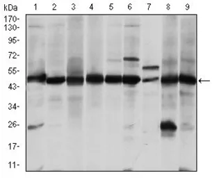 Anti-ASS1 antibody [2B10] used in Western Blot (WB). GTX60549
