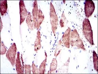 Anti-p70 S6K antibody [5G9] used in IHC (Paraffin sections) (IHC-P). GTX60550