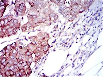 Anti-p70 S6K antibody [5G9] used in IHC (Paraffin sections) (IHC-P). GTX60550