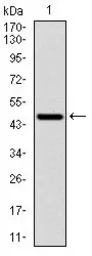 Anti-p70 S6K antibody [5G9] used in Western Blot (WB). GTX60550