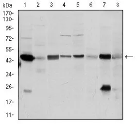 Anti-ASS1 antibody [2C10] used in Western Blot (WB). GTX60552