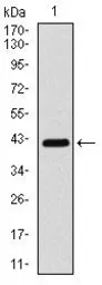 Anti-COTL1 antibody [5C8E3] used in Western Blot (WB). GTX60553